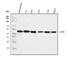 Invitrogen ADK Polyclonal Antibody 100 &mu;g; Unconjugated:Antibodies,