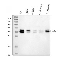 Invitrogen ADO Polyclonal Antibody 100 &mu;g | Buy Online | Invitrogen&trade; | Fisher Scientific