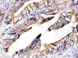 Invitrogen RAGE Polyclonal Antibody 100 &mu;g; Unconjugated:Antibodies,