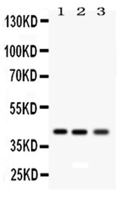 Invitrogen RAGE Polyclonal Antibody 100 &mu;g; Unconjugated:Antibodies,