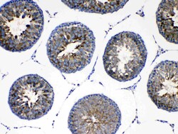 Invitrogen AgRP Polyclonal Antibody 100 &mu;g; Unconjugated:Antibodies,