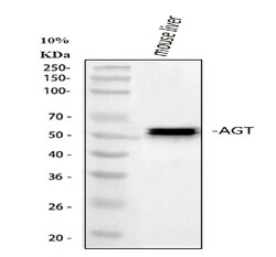 Invitrogen Angiotensinogen Polyclonal Antibody 100 &mu;g; Unconjugated:Antibodies,