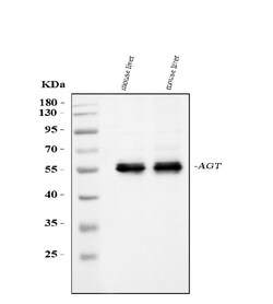 Invitrogen Angiotensinogen Polyclonal Antibody 100 &mu;g; Unconjugated:Antibodies,