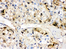 Invitrogen Fetuin A Polyclonal Antibody 100 &mu;g; Unconjugated:Antibodies,