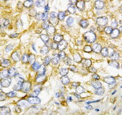 Invitrogen AIMP2 Polyclonal Antibody 100 &mu;g; Unconjugated:Antibodies,