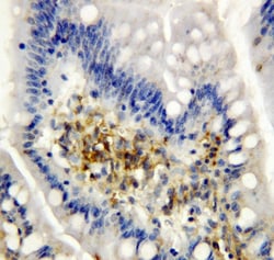 Invitrogen AIMP2 Polyclonal Antibody 100 &mu;g; Unconjugated:Antibodies,