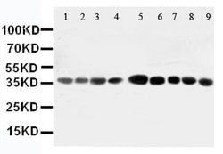 Invitrogen AIMP2 Polyclonal Antibody 100 &mu;g; Unconjugated:Antibodies,