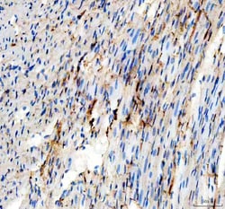 Invitrogen Adenylate Kinase 1 Polyclonal Antibody 100 &mu;g; Unconjugated:Antibodies,