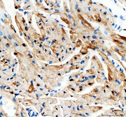 Invitrogen Adenylate Kinase 1 Polyclonal Antibody 100 &mu;g; Unconjugated:Antibodies,