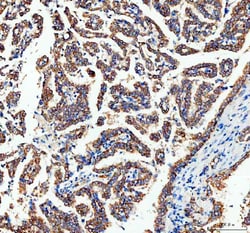 Invitrogen Adenylate Kinase 1 Polyclonal Antibody 100 &mu;g; Unconjugated:Antibodies,