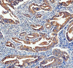 Invitrogen Adenylate Kinase 1 Polyclonal Antibody 100 &mu;g; Unconjugated:Antibodies,
