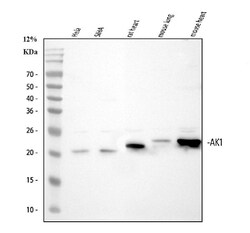Invitrogen Adenylate Kinase 1 Polyclonal Antibody 100 &mu;g; Unconjugated:Antibodies,