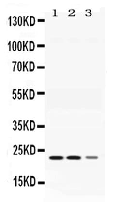 Invitrogen Adenylate Kinase 1 Polyclonal Antibody 100 &mu;g; Unconjugated:Antibodies,