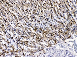 Invitrogen AKR1B1 Polyclonal Antibody 100 &mu;g; Unconjugated:Antibodies,