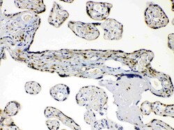 Invitrogen AKR1B1 Polyclonal Antibody 100 &mu;g; Unconjugated:Antibodies,