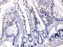 Invitrogen AKR1B1 Polyclonal Antibody 100 &mu;g; Unconjugated:Antibodies,