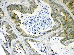 Invitrogen AKR1B10 Polyclonal Antibody 100 &mu;g; Unconjugated:Antibodies,
