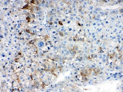 Invitrogen AKR1B10 Polyclonal Antibody 100 &mu;g; Unconjugated:Antibodies,
