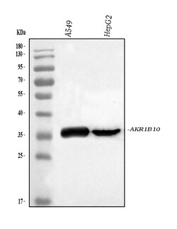 Invitrogen AKR1B10 Polyclonal Antibody 100 &mu;g; Unconjugated:Antibodies,
