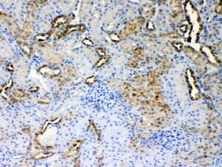 Invitrogen ALDH1A3 Polyclonal Antibody 100 &mu;g; Unconjugated:Antibodies,
