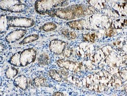 Invitrogen ALDH1A3 Polyclonal Antibody 100 &mu;g; Unconjugated:Antibodies,