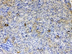Invitrogen ALDH1A3 Polyclonal Antibody 100 &mu;g; Unconjugated:Antibodies,