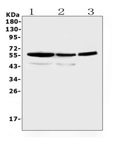 Invitrogen ALDH1A3 Polyclonal Antibody 100 &mu;g; Unconjugated:Antibodies,