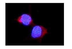 Invitrogen ALDH2 Polyclonal Antibody 100 &mu;g; Unconjugated:Antibodies,