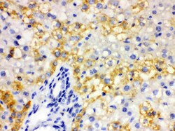Invitrogen ALDH2 Polyclonal Antibody 100 &mu;g; Unconjugated:Antibodies,