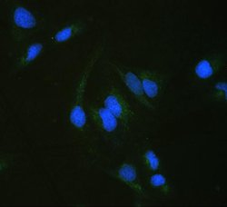 Invitrogen ALDH7A1 Polyclonal Antibody 100 &mu;g; Unconjugated:Antibodies,
