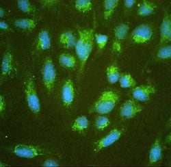 Invitrogen ALDH7A1 Polyclonal Antibody 100 &mu;g; Unconjugated:Antibodies,