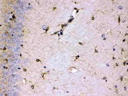 Invitrogen ALDH7A1 Polyclonal Antibody 100 &mu;g; Unconjugated:Antibodies,