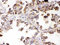 Invitrogen ALDH7A1 Polyclonal Antibody 100 &mu;g; Unconjugated:Antibodies,