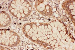 Invitrogen&trade;&nbsp;ALOX15 Polyclonal Antibody