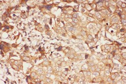 Invitrogen ALOX15 Polyclonal Antibody 100 &mu;g | Buy Online | Invitrogen&trade; | Fisher Scientific