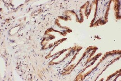 Invitrogen ALOX15 Polyclonal Antibody 100 &mu;g | Buy Online | Invitrogen&trade; | Fisher Scientific