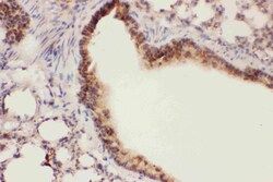 Invitrogen ALOX15 Polyclonal Antibody 100 &mu;g | Buy Online | Invitrogen&trade; | Fisher Scientific
