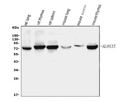 Invitrogen ALOX15 Polyclonal Antibody 100 &mu;g | Buy Online | Invitrogen&trade; | Fisher Scientific