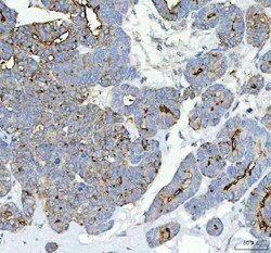 Invitrogen ALPL Polyclonal Antibody 100 &mu;g; Unconjugated:Antibodies,