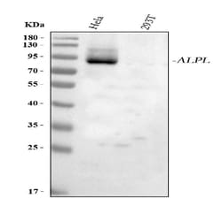 Invitrogen ALPL Polyclonal Antibody 100 &mu;g; Unconjugated:Antibodies,