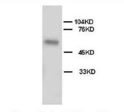 Invitrogen ALPL Polyclonal Antibody 100 &mu;g; Unconjugated:Antibodies,