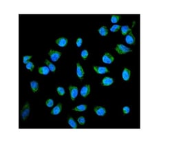 Invitrogen Placental Alkaline Phosphatase Polyclonal Antibody 100 &mu;g;