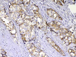 Invitrogen AMD1 Polyclonal Antibody 100 &mu;g; Unconjugated:Antibodies,