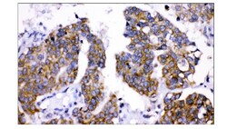 Invitrogen AMHR2 Polyclonal Antibody 100 &mu;g; Unconjugated:Antibodies,