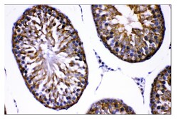 Invitrogen AMHR2 Polyclonal Antibody 100 &mu;g; Unconjugated:Antibodies,