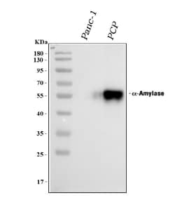 Invitrogen alpha Amylase 1 Polyclonal Antibody 100 &mu;g; Unconjugated:Antibodies,