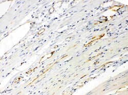Invitrogen ANGPTL2 Polyclonal Antibody 100 &mu;g; Unconjugated:Antibodies,