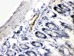 Invitrogen ANGPTL2 Polyclonal Antibody 100 &mu;g; Unconjugated:Antibodies,