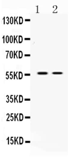 Invitrogen ANGPTL2 Polyclonal Antibody 100 &mu;g; Unconjugated:Antibodies,