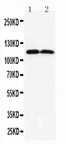 Invitrogen DOG-1 Polyclonal Antibody 100 &mu;g | Buy Online | Invitrogen&trade; | Fisher Scientific